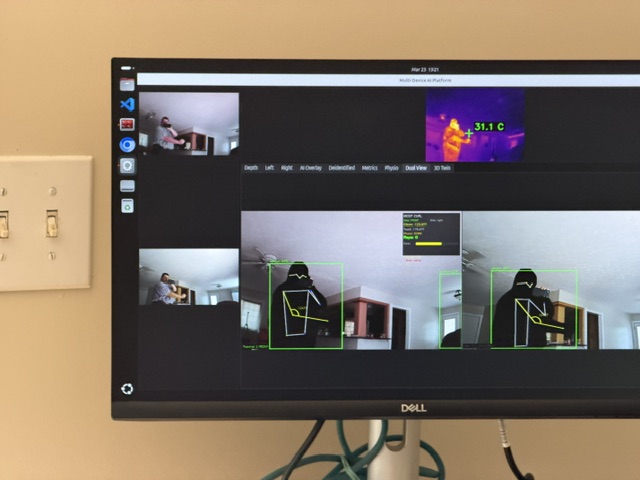 SmartCare Dementia AI